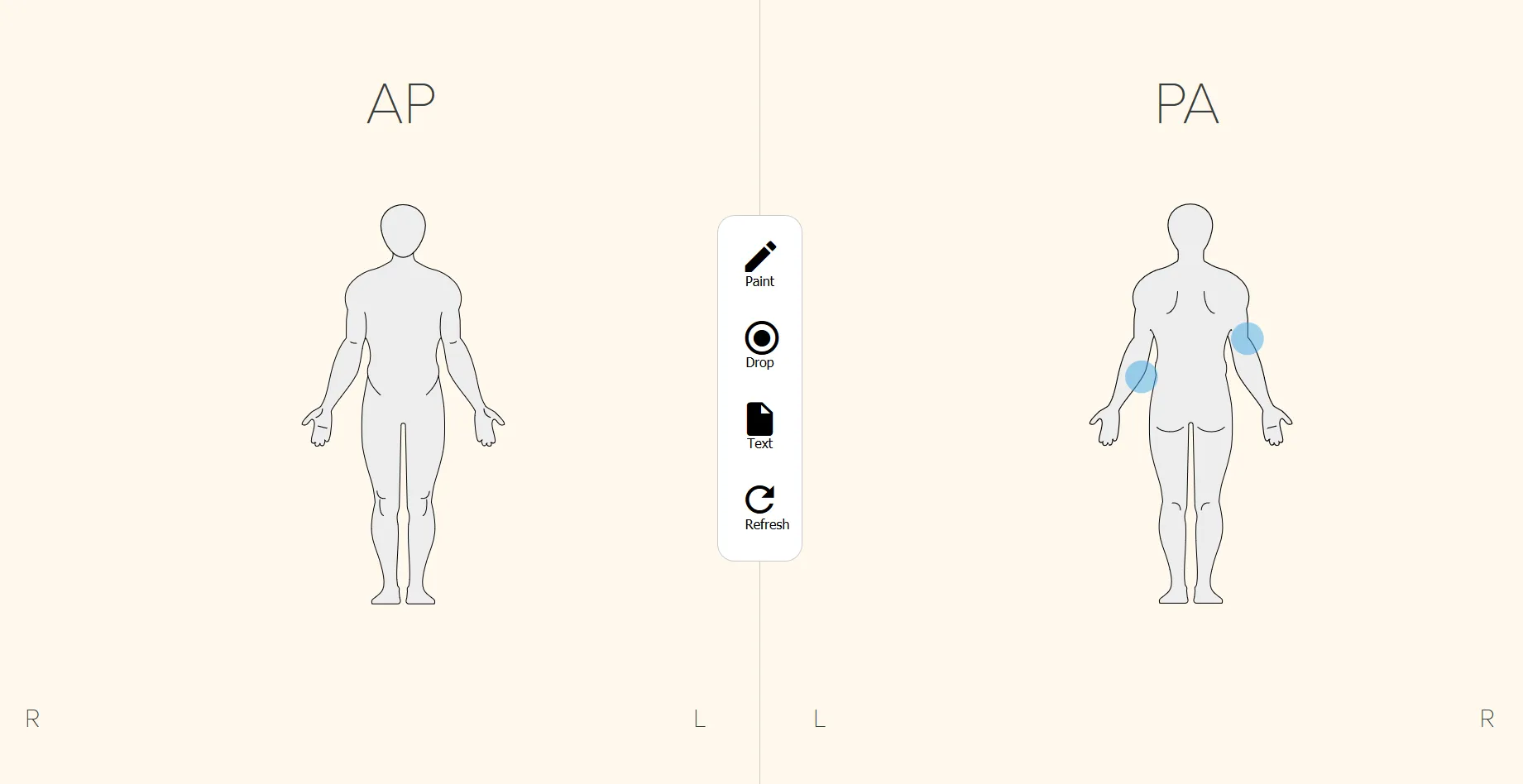 Second screenshot of the Noting UI